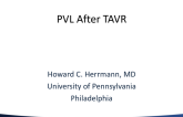Thoughtful Commentary: Mild-Moderate Paravalvular Regurgitation During/After TAVR