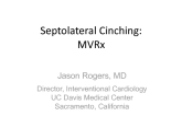 Septolateral Cinching II: MVRx