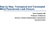Step by Step: Transapical and Transseptal Mitral Paravalvular Leak Closure