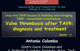 Valve Thrombosis After TAVR: Diagnosis and Treatment