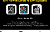 MRI Flow Characteristics in Different TAVI Systems