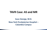 Case Presentation: MR and TAVR