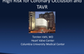 Case Presentation: High Risk for Coronary Occlusion and TAVR