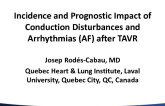 Incidence and Prognostic Impact of Conduction Disturbances and Arrhythmias (AF) After TAVR