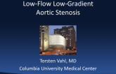 Case Presentation: Low Flow  Low Gradient AS and TAVR
