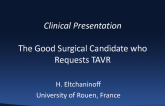 Case Presentation: The Good Surgical Candidate Who Requests TAVR