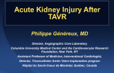 Acute Kidney Injury After TAVR: Incidence, Predictors, and Outcomes