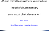 Thoughtful Commentary: AS and the Failing Bioprosthetic Mitral Valve