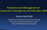 Prevention and Management of Conduction Disturbances and Arrhythmias (AF) After TAVR