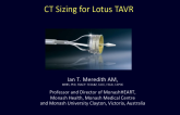 CT Sizing for Other New TAVR Systems: Roundtable Discussion - Lotus Valve