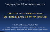 TEE of the Mitral Valve: Nuances Specific to MR Assessment for MitraClip