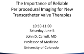 The Importance of Reliable Periprocedural Imaging for New Transcatheter Valve Therapies