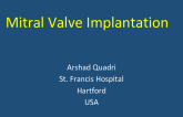 Mitral Valve Implantation