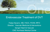 Endovascular Treatment of DVT