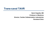 Trans-caval TAVR