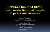 DISSECTION MAYHEM: Endovascular Repair of Complex Type B Aortic Dissection