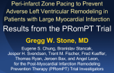 Peri-infarct Zone Pacing to Prevent  Adverse Left Ventricular Remodeling in Patients with Large Myocardial Infarction: Results from the PRomPT Trial