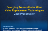Emerging Transcatheter Mitral Valve Replacement Technologies