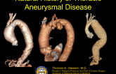 Natural History of Thoracic Aneurysmal Disease
