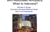 Bicuspid Aortic Valve-associated Aortopathy: When to intervene?
