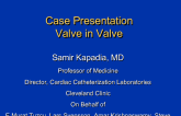 Case Presentations/Taped TAVR Case Segments