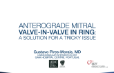 CASE 3: Anterograde Mitral Valve-in-Valve-in-Ring: The Solution for a Tricky Issue