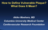 How to Define Vulnerable Plaque? What Does It Mean?