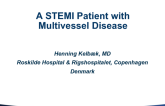 Case Introduction: A STEMI Patient With Multivessel Disease