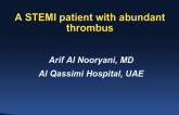 Case Introduction: A STEMI Patient With Abundant Thrombus