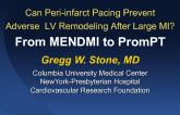Can Peri-infarct Pacing Prevent Adverse Left Ventricular Remodeling After Large MI? From MENDMI to PRomPT