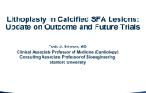 Lithoplasty in Calcified SFA Lesions: Update on Outcomes and Future Trials