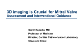 3-D Imaging Is Crucial for Mitral Valve Assessment and Interventional Guidance