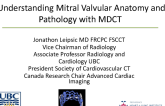 Emerging Role of CT for Assessment of Mitral Valve Anatomy and Dysfunction