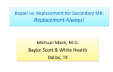 Debate: Repair vs Replacement for Secondary MR: Replacement Always!