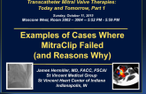 Examples of Cases Where MitraClip Failed (and Reasons Why)