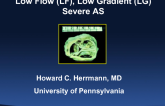 Status Updates on New TAVR Indications 2: Low-Flow (Low-Gradient) AS