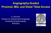 Angiography-Guided Proximal, Mid, and Distal Tibial Access