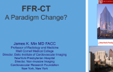 FFR-CT (Pre-PLATFORM data): A Paradigm Change?