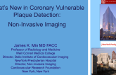 Whats New in Coronary Vulnerable Plaque Detection: Noninvasive Imaging