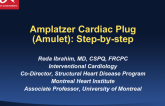 Amplatzer Cardiac Plug (ACP) Step-by-Step