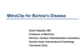 MitraClip Approach to Barlow's Disease