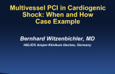 Multivessel PCI in Cardiogenic Shock: When and How