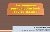 India Presents: Redo of Device Closure With Mitral Paravalvular Leak