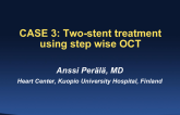Case 3: Two-Stent Treatment Using Stepwise OCT