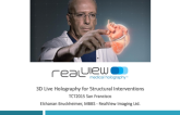 3D Holography for Structural Interventions: The Next Phase