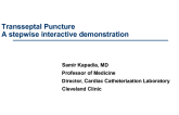 The Trans-Septal Technique: A Step-Wise Interactive Demonstration