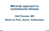 MitraClip Approach to Commissural Disease