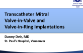 Transcatheter Valve Replacement for Mitral Bioprosthetic Valve and Ring Annuloplasty Failures: Multicenter VIVID Registry Results