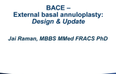 Bace External Basal Annuloplasty Device: Design and Update