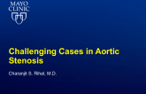 Low Flow: Low-Gradient Aortic Stenosis and TAVR  Case Presentation